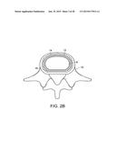 IN-SITU FORMED INTERVERTEBRAL FUSION DEVICE AND METHOD diagram and image