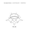 IN-SITU FORMED INTERVERTEBRAL FUSION DEVICE AND METHOD diagram and image