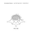 IN-SITU FORMED INTERVERTEBRAL FUSION DEVICE AND METHOD diagram and image