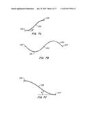 DEVICES AND METHODS FOR CONTROLLED ENDOLUMINAL FILTER DEPLOYMENT diagram and image