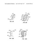 DEVICES AND METHODS FOR CONTROLLED ENDOLUMINAL FILTER DEPLOYMENT diagram and image