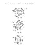 DEVICES AND METHODS FOR CONTROLLED ENDOLUMINAL FILTER DEPLOYMENT diagram and image