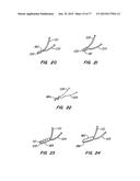 DEVICES AND METHODS FOR CONTROLLED ENDOLUMINAL FILTER DEPLOYMENT diagram and image