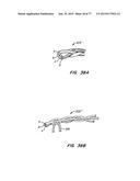 DEVICES AND METHODS FOR CONTROLLED ENDOLUMINAL FILTER DEPLOYMENT diagram and image