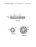 DEVICES AND METHODS FOR CONTROLLED ENDOLUMINAL FILTER DEPLOYMENT diagram and image