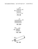 DEVICES AND METHODS FOR CONTROLLED ENDOLUMINAL FILTER DEPLOYMENT diagram and image