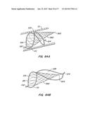 DEVICES AND METHODS FOR CONTROLLED ENDOLUMINAL FILTER DEPLOYMENT diagram and image