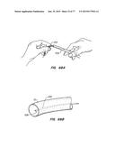 DEVICES AND METHODS FOR CONTROLLED ENDOLUMINAL FILTER DEPLOYMENT diagram and image