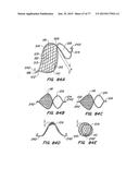 DEVICES AND METHODS FOR CONTROLLED ENDOLUMINAL FILTER DEPLOYMENT diagram and image