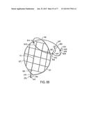 DEVICES AND METHODS FOR CONTROLLED ENDOLUMINAL FILTER DEPLOYMENT diagram and image