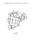 DEVICES AND METHODS FOR CONTROLLED ENDOLUMINAL FILTER DEPLOYMENT diagram and image