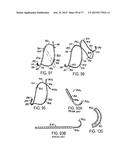 DEVICES AND METHODS FOR CONTROLLED ENDOLUMINAL FILTER DEPLOYMENT diagram and image