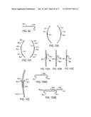 DEVICES AND METHODS FOR CONTROLLED ENDOLUMINAL FILTER DEPLOYMENT diagram and image