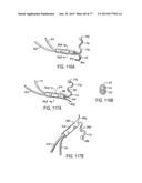 DEVICES AND METHODS FOR CONTROLLED ENDOLUMINAL FILTER DEPLOYMENT diagram and image