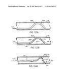 DEVICES AND METHODS FOR CONTROLLED ENDOLUMINAL FILTER DEPLOYMENT diagram and image