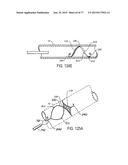 DEVICES AND METHODS FOR CONTROLLED ENDOLUMINAL FILTER DEPLOYMENT diagram and image