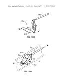 DEVICES AND METHODS FOR CONTROLLED ENDOLUMINAL FILTER DEPLOYMENT diagram and image