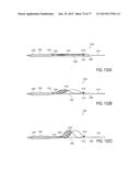 DEVICES AND METHODS FOR CONTROLLED ENDOLUMINAL FILTER DEPLOYMENT diagram and image