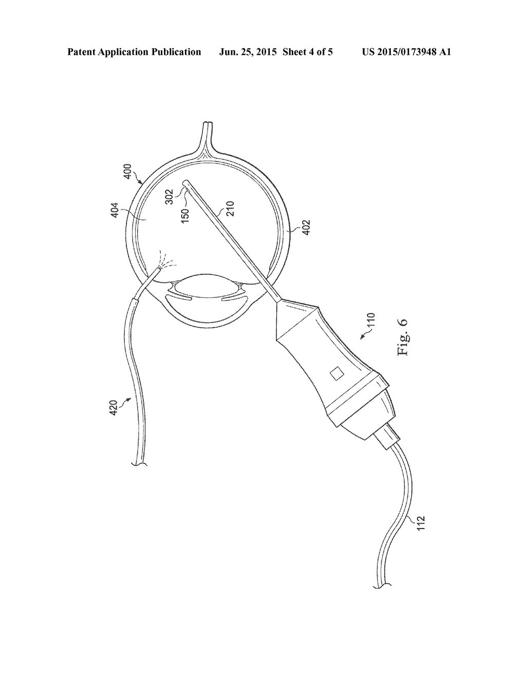 Tissue-Sensing Vitrectomy Surgical Systems and Methods - diagram, schematic, and image 05