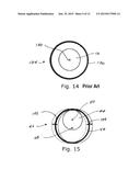 Apparatus And Method For Phacoemulsification diagram and image