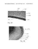 Apparatus And Method For Phacoemulsification diagram and image