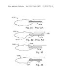 Apparatus And Method For Phacoemulsification diagram and image