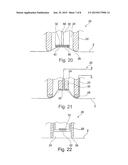 METHOD FOR TREATING THE SKIN AND DEVICE diagram and image