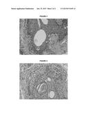 BERBERINE FORMULATIONS AND USES THEREOF diagram and image