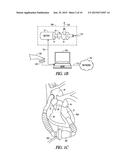 CARDIAC ASSIST DEVICE WITH PULSE WAVE ANALYSIS diagram and image