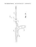 BIOINJECTION DEVICE diagram and image