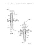 SYRINGE SAFETY ASSEMBLY diagram and image