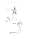 TRACHEOSTOMY TUBE AND TECHNIQUE FOR USING THE SAME diagram and image