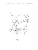 FIXATION CONTROL FOR A PATIENT INTERFACE diagram and image