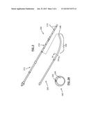 PLEURODESIS DEVICE AND METHOD diagram and image