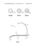 PLEURODESIS DEVICE AND METHOD diagram and image