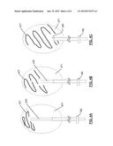 PLEURODESIS DEVICE AND METHOD diagram and image