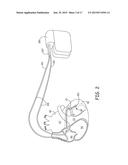 LEAD DELIVERY DEVICE AND METHOD diagram and image