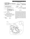 LEADLESS PACEMAKER WITH END-OF-LIFE PROTECTION diagram and image