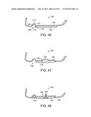 GOLF CLUB HEAD WITH FLEXURE diagram and image