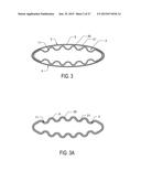 ASSEMBLY BRACKET AND MOUNTING SYSTEM FOR AERATION ELEMENT diagram and image