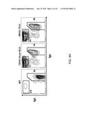 Human Lambda Light Chain Mice diagram and image