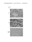 TRANSGENIC PLANTS EXPRESSING A pH-SENSITIVE NITRATE TRANSPORTER diagram and image