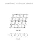 Expandable Web Material Having Curvilinear Structure diagram and image