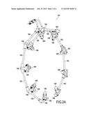 DUAL-CIRCUIT MODULAR INJECTION TUBE diagram and image