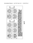 MAGNETIC RESONANCE IMAGING SYSTEMS FOR INTEGRATED PARALLEL RECEPTION,     EXCITATION AND SHIMMING AND RELATED METHODS AND DEVICES diagram and image