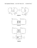 NON-INVASIVE PROSTATE COIL FOR MR SYSTEMS WITH VERTICAL MAIN FIELD diagram and image