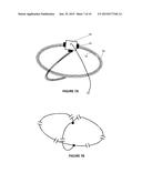 NON-INVASIVE PROSTATE COIL FOR MR SYSTEMS WITH VERTICAL MAIN FIELD diagram and image