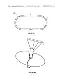 NON-INVASIVE PROSTATE COIL FOR MR SYSTEMS WITH VERTICAL MAIN FIELD diagram and image