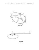 NON-INVASIVE PROSTATE COIL FOR MR SYSTEMS WITH VERTICAL MAIN FIELD diagram and image