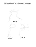 HIGH ACCESS CONSUMABLES FOR A PLASMA ARC CUTTING SYSTEM diagram and image